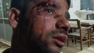 Photo of भाजपा नेता के भाई पर जानलेवा हमला,रिपोर्ट दर्ज